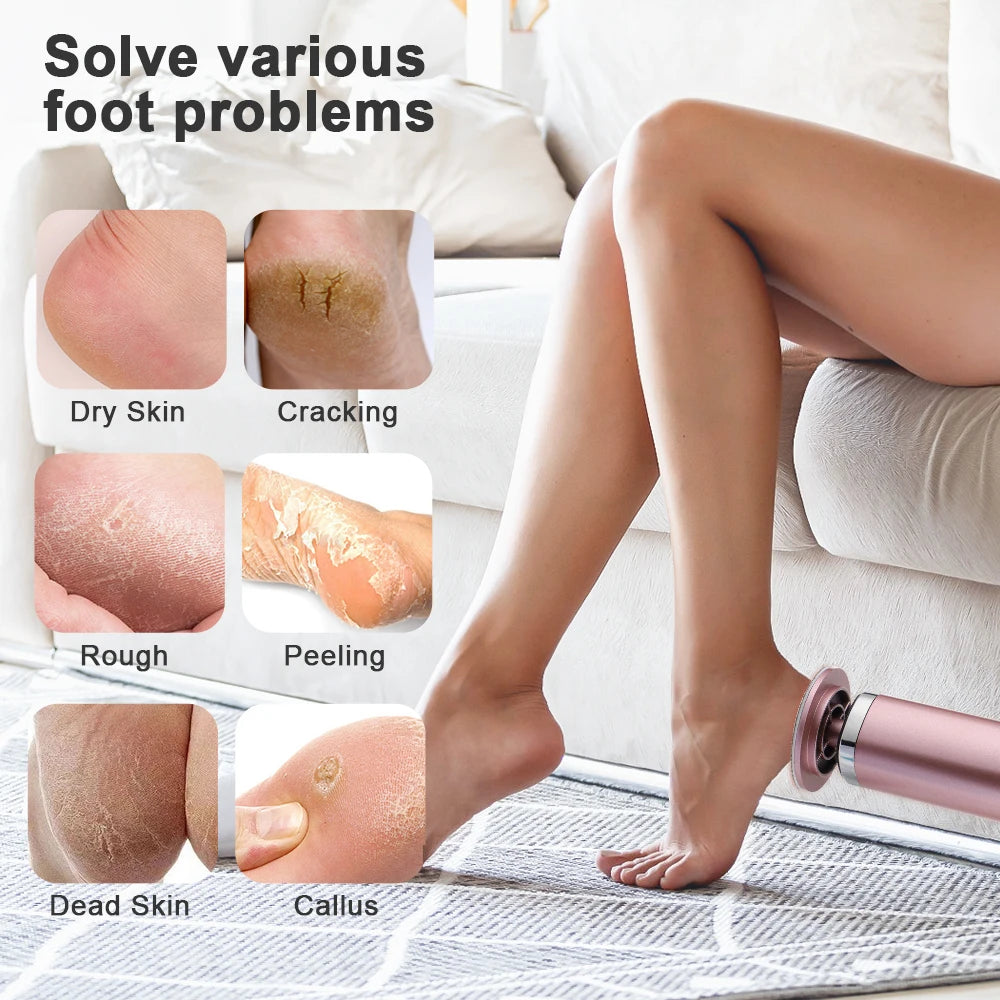 Callum Remover + 60 free filing pads